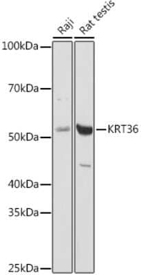 Western Blot: Keratin 36 Antibody [NBP3-03706] - Western blot analysis of extracts of various cell lines, using (NBP3-03706) at 1:1000 dilution. Secondary antibody: HRP Goat Anti-Rabbit IgG (H+L) at 1:10000 dilution. Lysates/proteins: 25ug per lane. Blocking buffer: 3% nonfat dry milk in TBST. Detection: ECL Basic Kit. Exposure time: 10s.